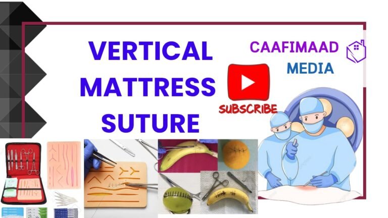 VERTICAL MATTRESS SUTURE